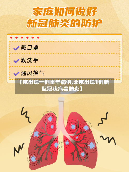 【京出现一例重型病例,北京出现1例新型冠状病毒肺炎】-第3张图片