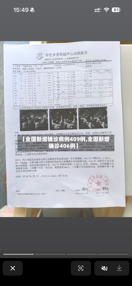 【全国新增确诊病例409例,全国新增确诊406例】-第3张图片